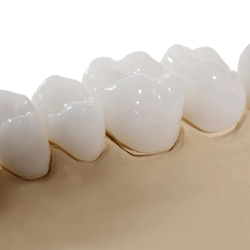 10 điều cần biết khi đi nhổ răng